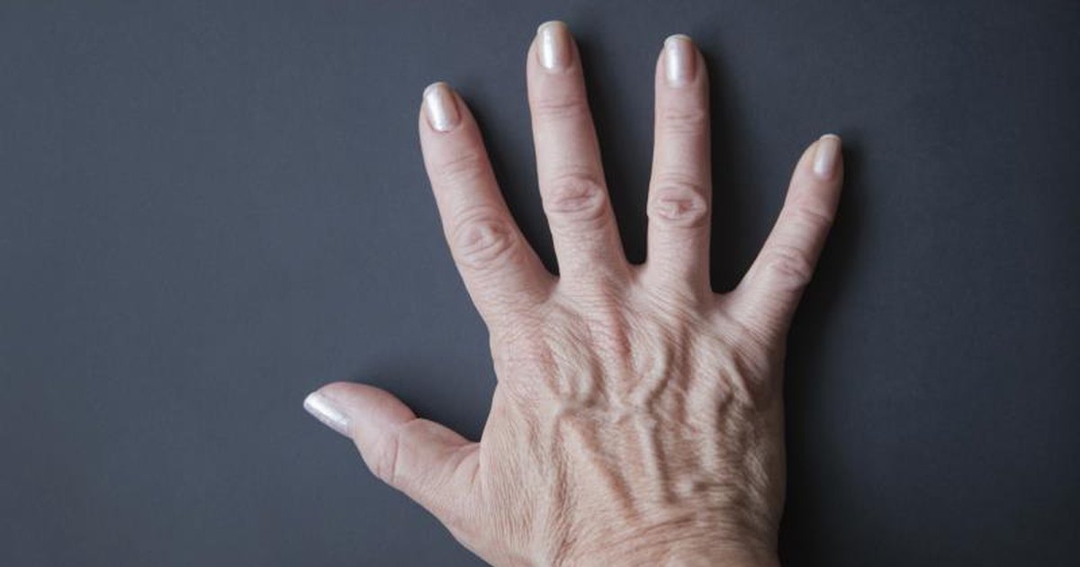What Causes Sudden Swollen Hands?