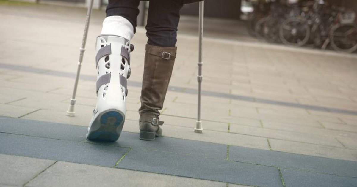 How to Lose the Weight Gained When an Ankle Is Broken | LIVESTRONG.COM How To Make Money With A Broken Foot