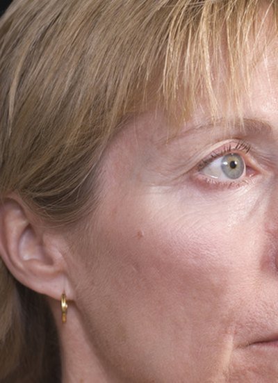 What causes numbness on one side of a person's face?