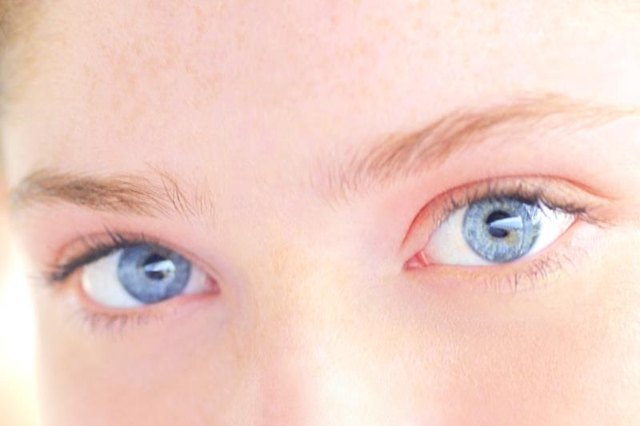 What Is the Meaning of Red Eyes & Dark Circles Under the Eyes in Children?
