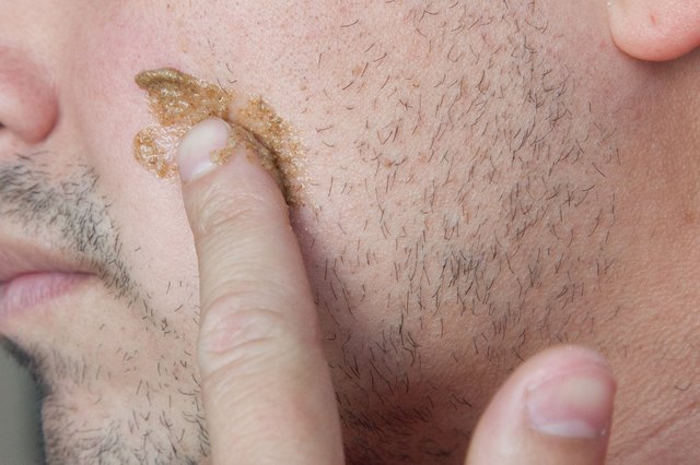 Can You Remove Facial Hair With Salt?