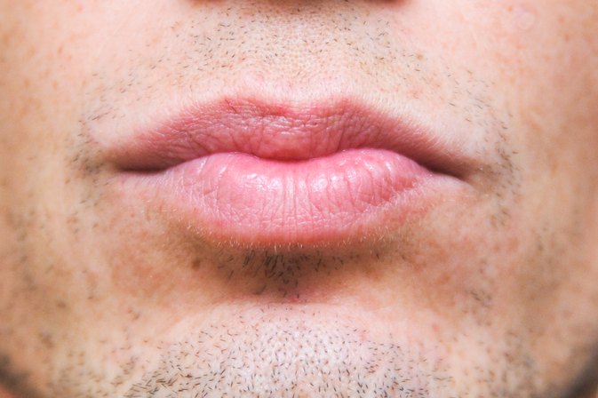 How to Remove Nicotine Stains From Lips