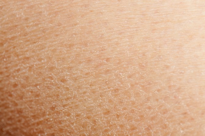 How To Improve Extremely Dry Skin Livestrongcom