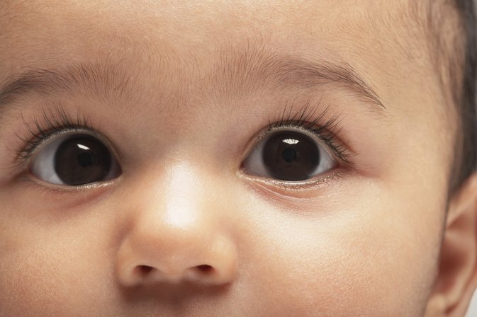 Adverse Effects of Gentamicin Eye Drops on Babies ...