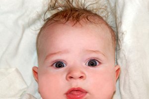 Can Cradle Cap Make a Baby's Hair Fall Out? | LIVESTRONG.COM