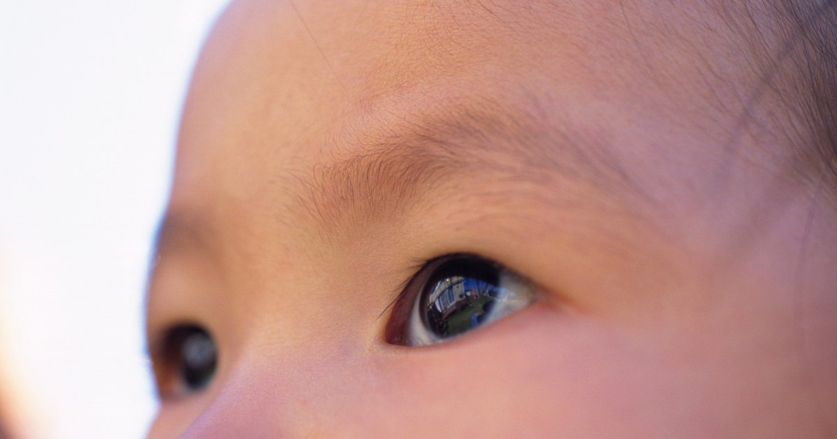 Белки глаз новорожденного. Глаза у новорожденных. Разрез глаз у новорожденных. Глаза новорожденного ребенка. Разрез глаза у новорожденного.