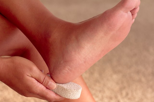 How to Soak Dry Cracked Feet